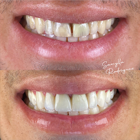 Dentista em Petrolina - Samylla Rodriguez