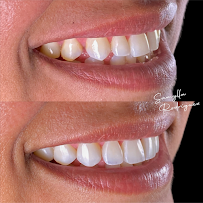 Dentista em Petrolina - Samylla Rodriguez