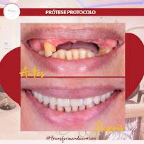 Design Oral: Dentista, Facetas, Clareamento, Implantes, Próteses em Cascavel PR
