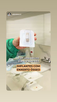 Odonto Luzzi - Luzzi Odontologia - Implante Dentário, Clareamento Dental, Próteses,Aparelho Ortodôntico, Facetas em Cascavel