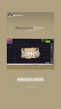 Odonto Luzzi - Luzzi Odontologia - Implante Dentário, Clareamento Dental, Próteses,Aparelho Ortodôntico, Facetas em Cascavel
