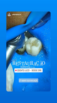 Odonto Luzzi - Luzzi Odontologia - Implante Dentário, Clareamento Dental, Próteses,Aparelho Ortodôntico, Facetas em Cascavel