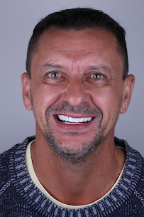 Clínica Bitencourt - Facetas de Resina e Odontologia Estética