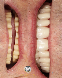 Implant Dentistry Center Maison