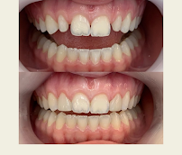 Lube Odontologia - Implantes Blumenau