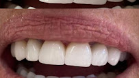 Lube Odontologia - Implantes Blumenau