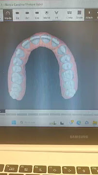 Lube Odontologia - Implantes Blumenau