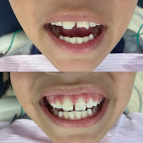 Lube Odontologia - Implantes Blumenau