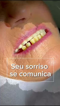 Catarinense Implantes Blumenau