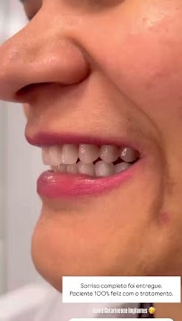 Catarinense Implantes Blumenau