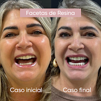 Clínica Brunsfeld Odontologia Estética