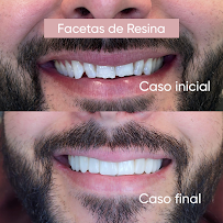 Clínica Brunsfeld Odontologia Estética