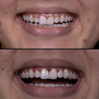 Dentista Dr. Rafael Chiarello