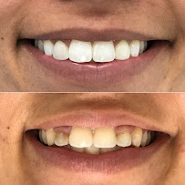 Vivant Odontologia Especializada | Implantes Dentários Campina Grande