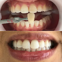 Vivant Odontologia Especializada | Implantes Dentários Campina Grande