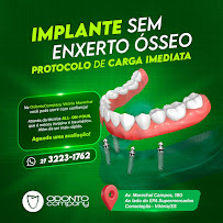 Odontocompany Marechal Campos | Implante, Prótese e Protocolo em Vitória ES