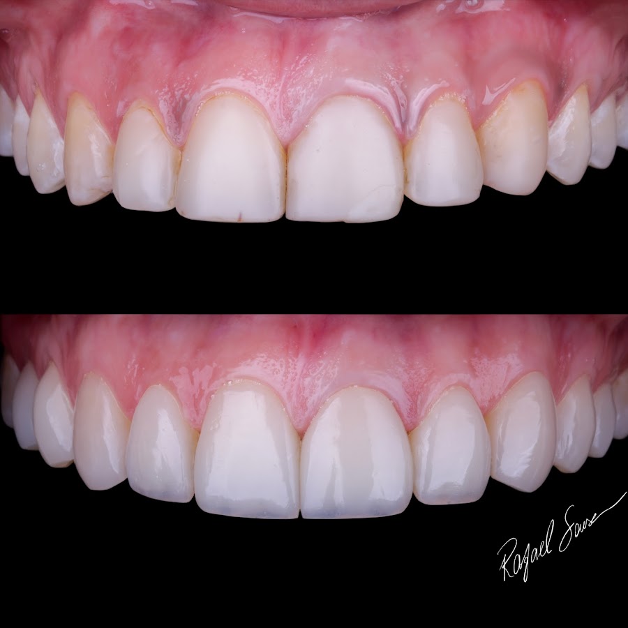 Dr. Rafael Sousa - dental clinic in Vitória