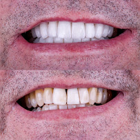 Dr. Rafael Sousa | Odontologia Estética e Lentes de Contato Dental