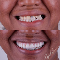Dr. Rafael Sousa | Odontologia Estética e Lentes de Contato Dental