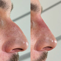 Dr. Rafael Sousa | Odontologia Estética e Lentes de Contato Dental
