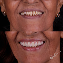 Dr. Rafael Sousa | Odontologia Estética e Lentes de Contato Dental