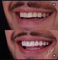 Dr. Rafael Sousa | Odontologia Estética e Lentes de Contato Dental