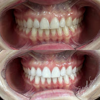 Dr. Rafael Sousa | Odontologia Estética e Lentes de Contato Dental