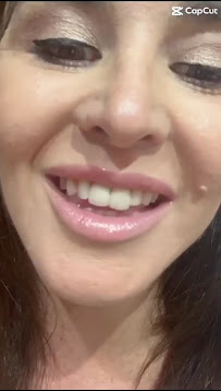 Dr. Rafael Sousa | Odontologia Estética e Lentes de Contato Dental