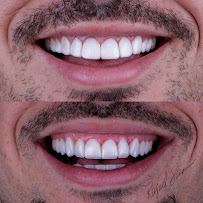 Dr. Rafael Sousa | Odontologia Estética e Lentes de Contato Dental