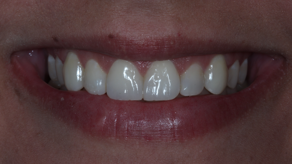 Dra. Ananda Jasson - dental clinic in Vitória, Brazil