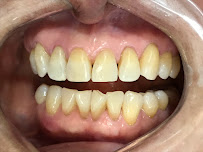 Dra. Ananda Jasson- Dentista. Tratamento de canal- Placa de bruxismo- Clareamento dental- Próteses - Implantes