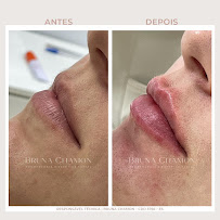 Bruna Chamon | Odontologia e Harmonização Facial