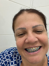 Propulsão Dental