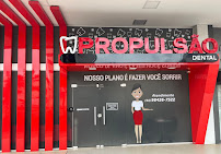 Propulsão Dental