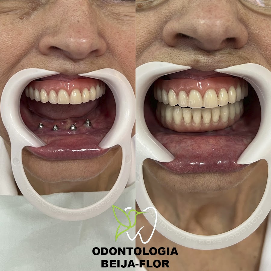 Odontologia Beija-Flor - dental clinic in Maringá, Brazil