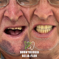 Odontologia Beija-Flor
