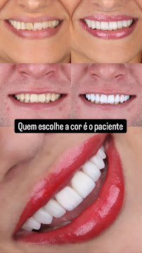 Dra Virgínia Almeida | Illumine Clínica Odontológica