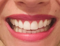Blumie Dental Care - Dra. Patricia Brito