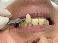 Alcantara Odontologia e Implantes - Clínica de Implante dentário em Maringá