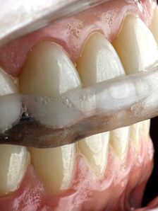 Oralle Studio Dental - Dentista Maringá - Invisalign