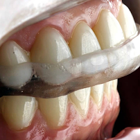 Oralle Studio Dental - Dentista Maringá - Invisalign