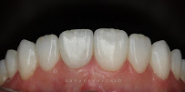 Oralle Studio Dental - Dentista Maringá - Invisalign