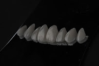 Oralle Studio Dental - Dentista Maringá - Invisalign