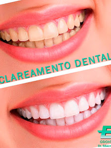 Dr. Eduardo F. Galbiati - Implantes dentários e Invisalign
