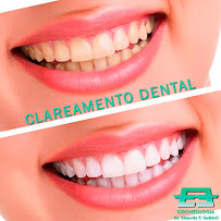 Dr. Eduardo F. Galbiati - Implantes dentários e Invisalign