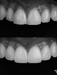 Dr. Guilherme Boselli - Odontologia Autoral