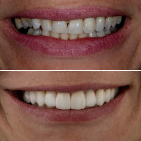 Dr. Guilherme Boselli - Odontologia Autoral