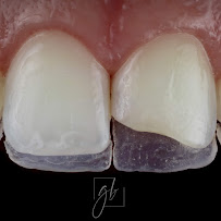 Dr. Guilherme Boselli - Odontologia Autoral