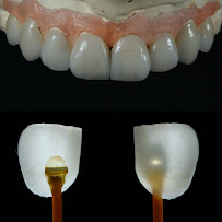 Dr. Guilherme Boselli - Odontologia Autoral