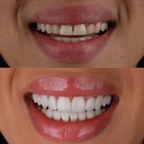Nive Odontologia